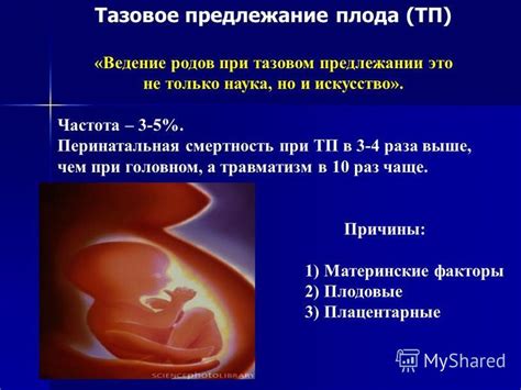 Возможные причины движения плода выше пупка