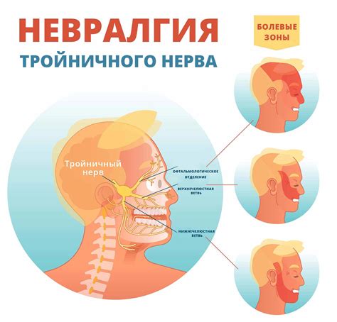 Возможные причины застуды тройничного нерва