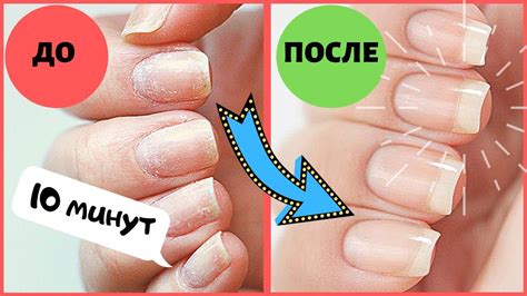 Возможные риски и побочные эффекты от использования гель лака в 13 лет