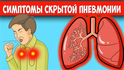 Воспаление легких: как распознать