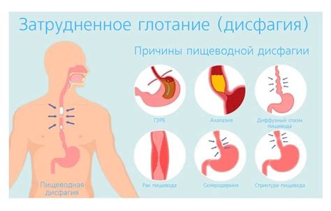 Воспалительные заболевания горла и пищевода