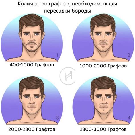 Выбор момента для пересадки