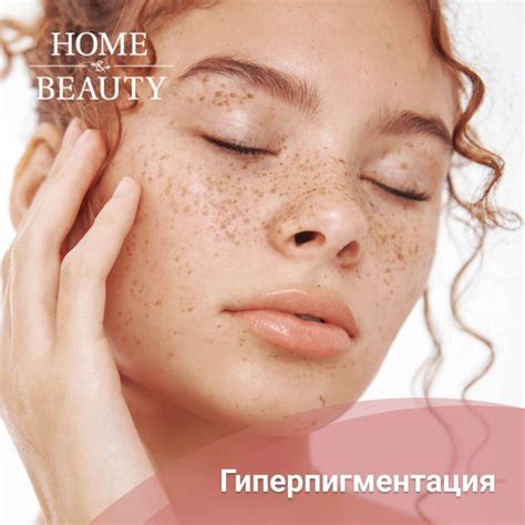 Генетическая предрасположенность к потемнению кожи