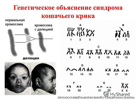 Генетическое объяснение глухоты