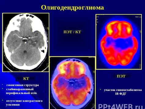 Главные преимущества КТ в диагностике сотрясений головного мозга