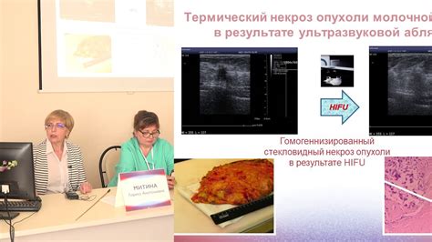 Грелка как альтернатива хирургическому вмешательству