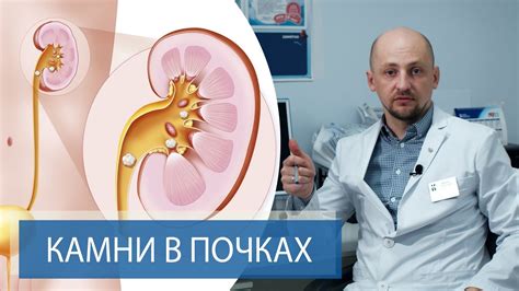 Грелка при камнях в почках