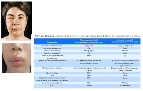 Дефекты системы питания