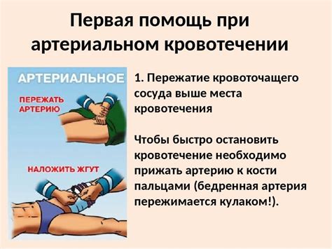 Диагностика внутреннего кровотечения: симптомы и методы обнаружения