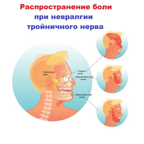 Диагностика застуды тройничного нерва