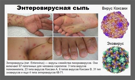 Диагностика и лечение инфекции