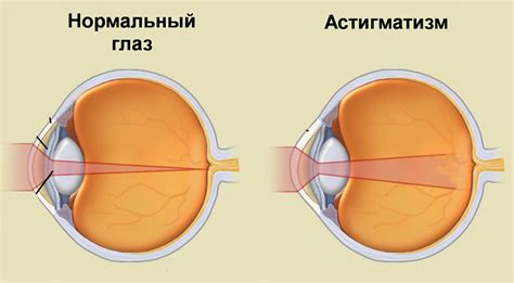 Диагностика и последствия заболевания