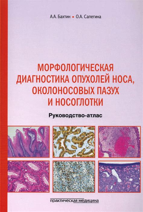Диагностика опухолей
