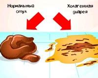 Диарея: причины и симптомы