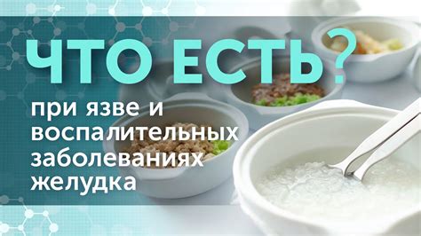 Диета при язве желудка