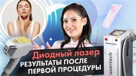 Диодный лазер после процедуры