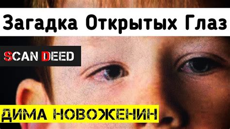 Загадка: "Щека когда глаз око 6 букв"