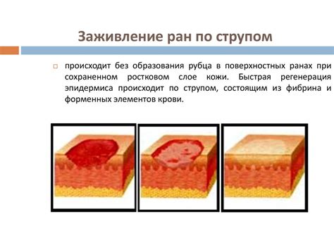 Заживление ран и предотвращение инфекции