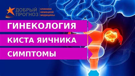 Заниматься близостью при кисте: что говорят эксперты