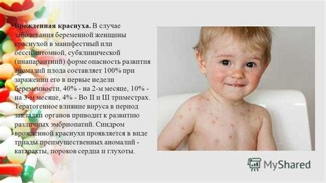 Заражение вторичной ветрянкой: как избежать