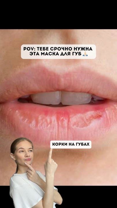 Избегайте снятия корки на ранке