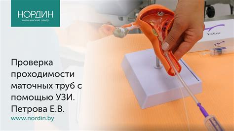 Инструменты для определения проходимости маточных труб