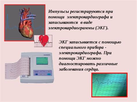 Интерпретация ЭКГ: как диагностировать заболевания сердца