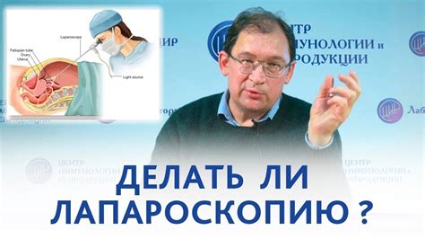Исследование: проводят ли лапароскопию после абдоминальной операции