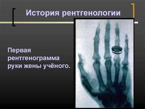 История рентгенологии в России