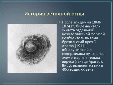История эпидемии оспы