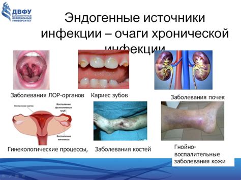 Источники инфекции и возможные последствия