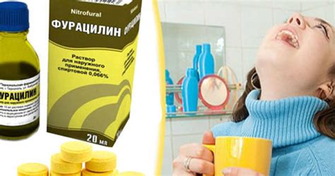 Какая жидкость противопоказана после полоскания фурацилином