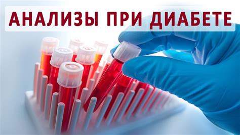 Какие анализы сдавать