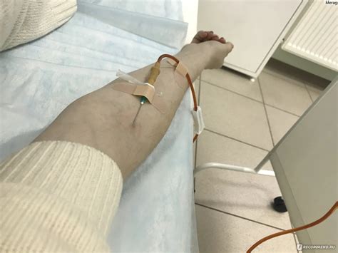 Какие результаты достигают пациенты после процедуры с капельницей