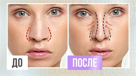 Какие советы помогут сохранить форму носа при похудении