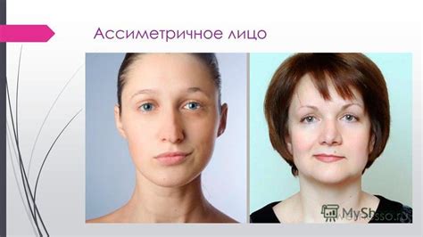 Какие факторы могут способствовать возникновению асимметрии лица