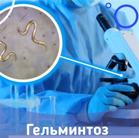 Какими способами можно предотвратить заражение паразитами