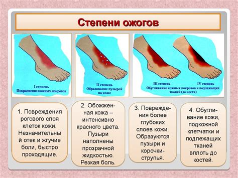 Как бороться с повышенной температурой после ожога
