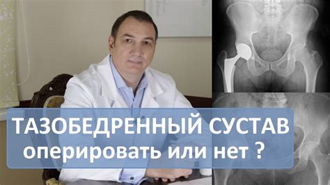 Как восстановиться после замены сустава