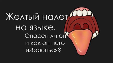 Как избавиться от желтого налета на языке