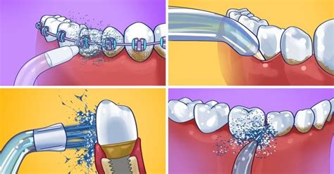 Как избежать открытого рта: советы и рекомендации