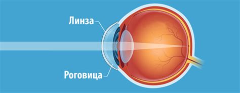 Как избежать повреждения глаза