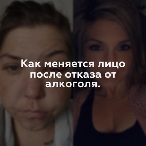 Как меняется поведение близнецов после расторжения отношений