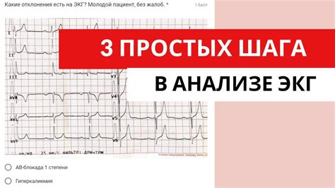 Как ношение колготок влияет на возможность снятия ЭКГ