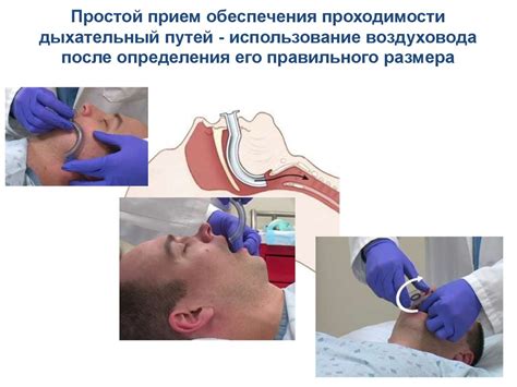 Как обеспечить доступность дыхательных путей