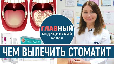 Как пить колу, если у вас стоматит: советы от стоматологов