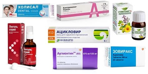 Как помочь ребенку при стоматите