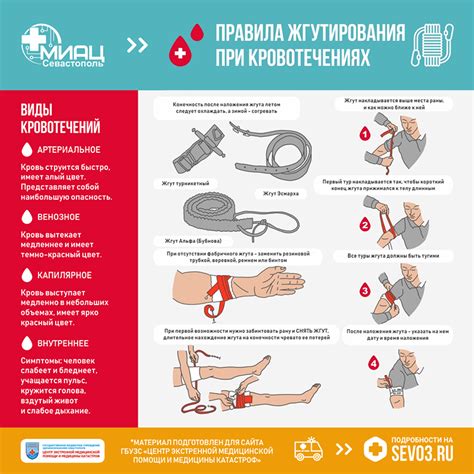 Как поступать при кровотечении