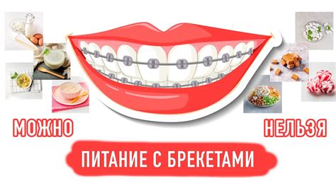 Как правильно есть бургеры с брекетами