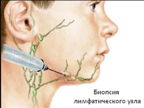 Как предотвратить воспаление лимфоузла на голове
